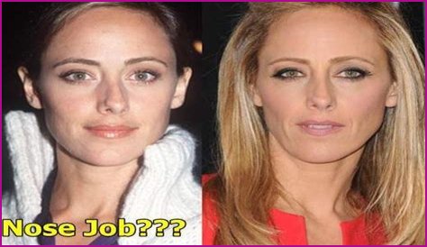 Kim Raver Plastic Surgery Before and After