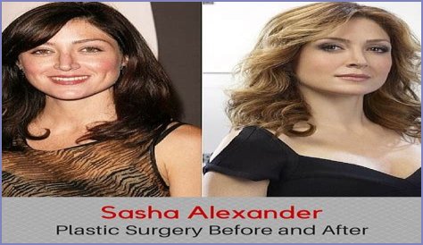 Sasha Alexander Plastic Surgery Before and After